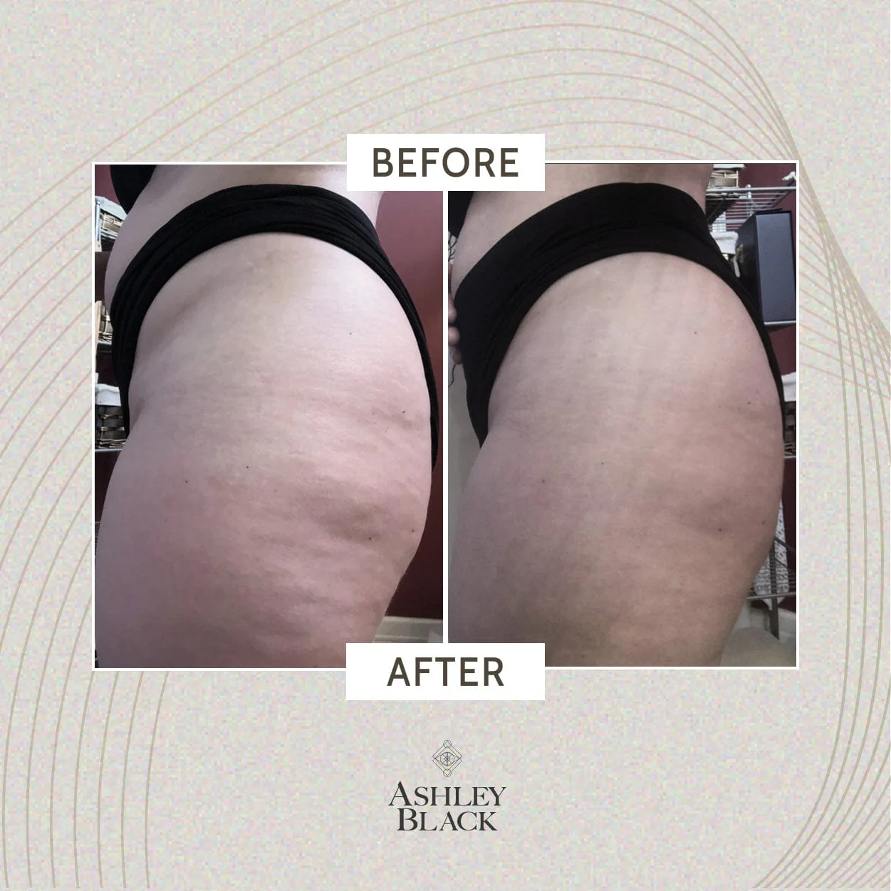 Ashley Black's Kryopack™ Wrap - Image 5