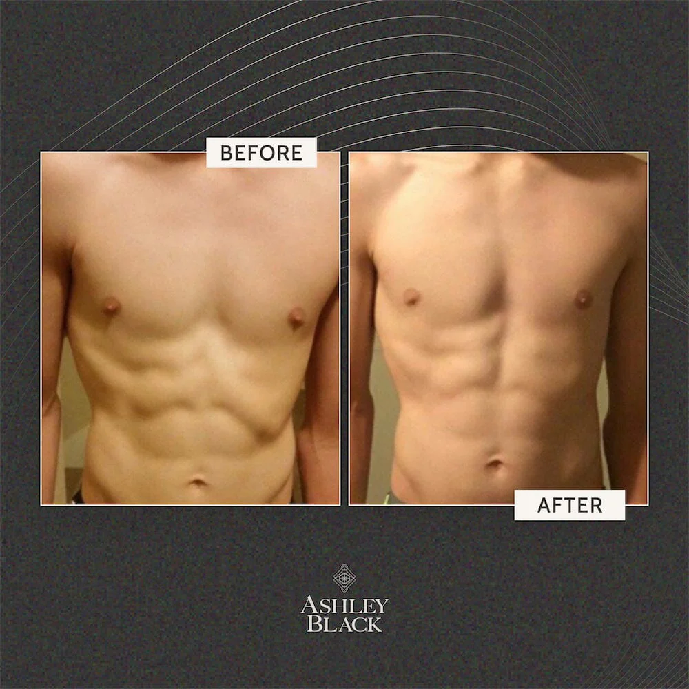 BigDaddy FasciaBlaster® - Image 8