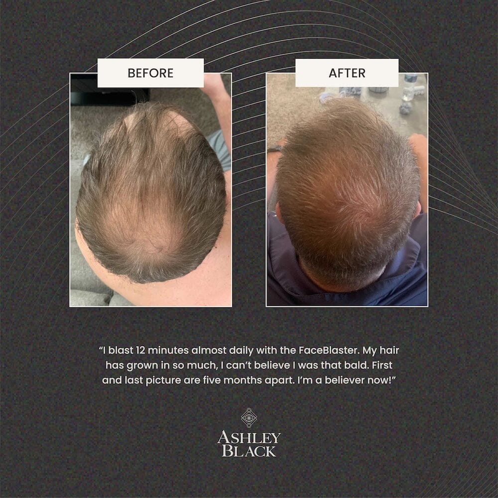 FaceBlaster™ - Image 7