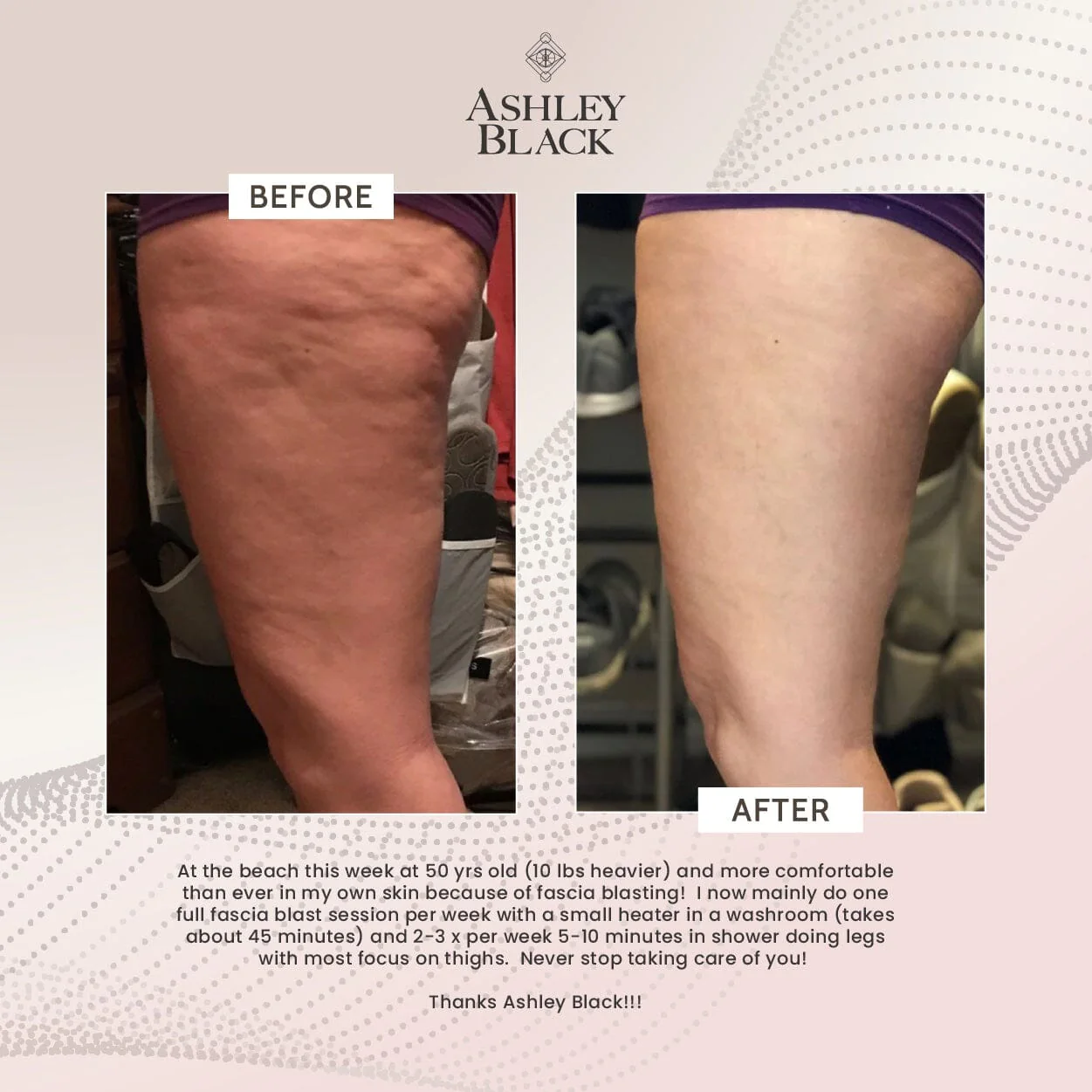 FasciaBlaster® - Image 4