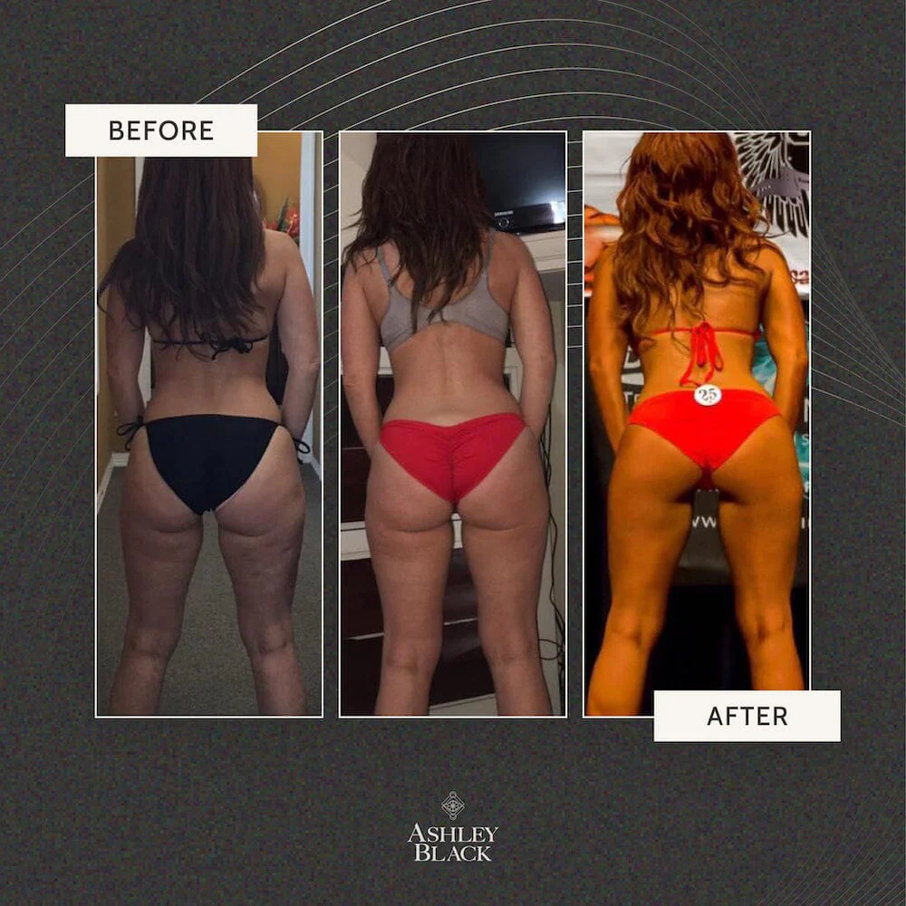 FasciaBlaster® - Image 9