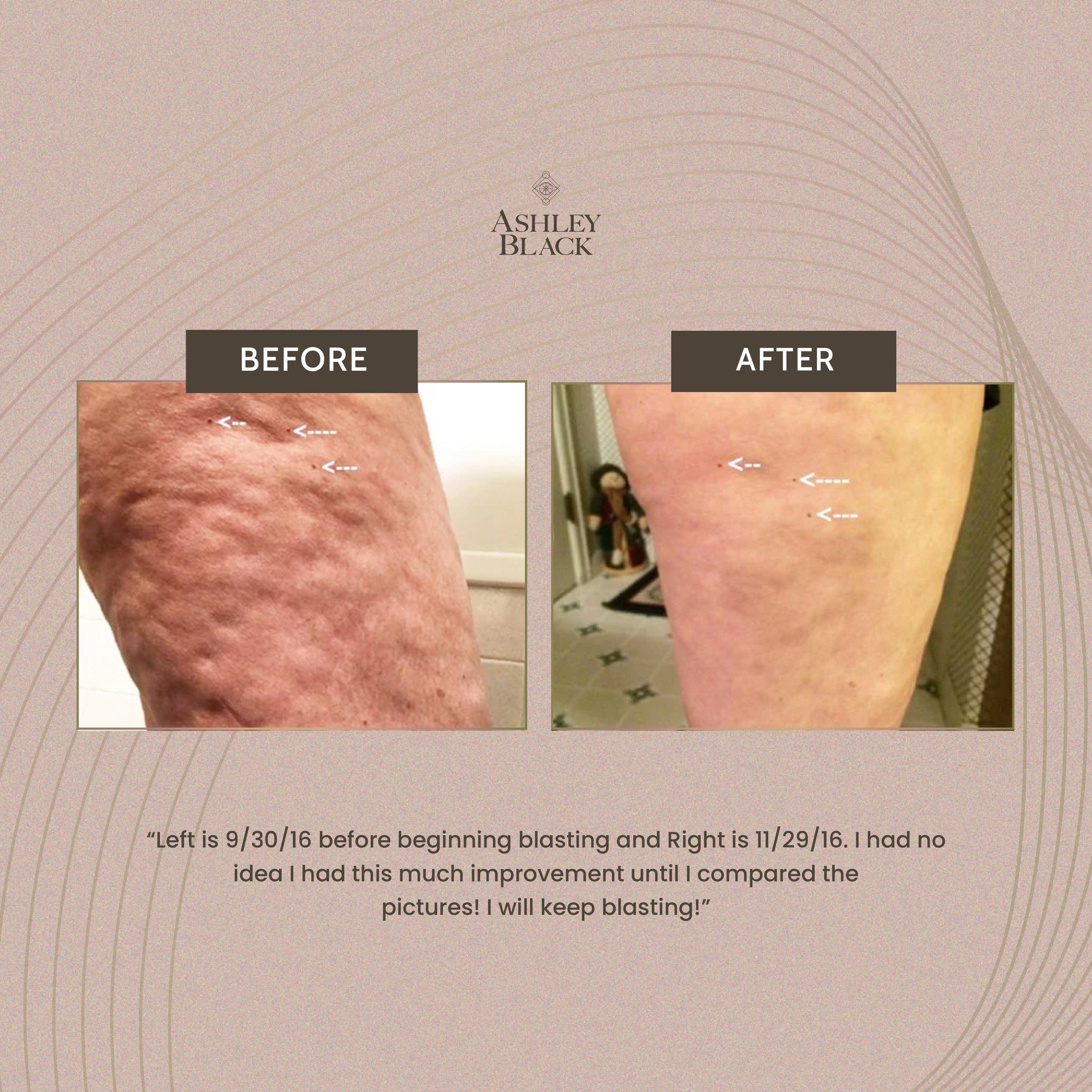 MasterBlaster™ - Image 5