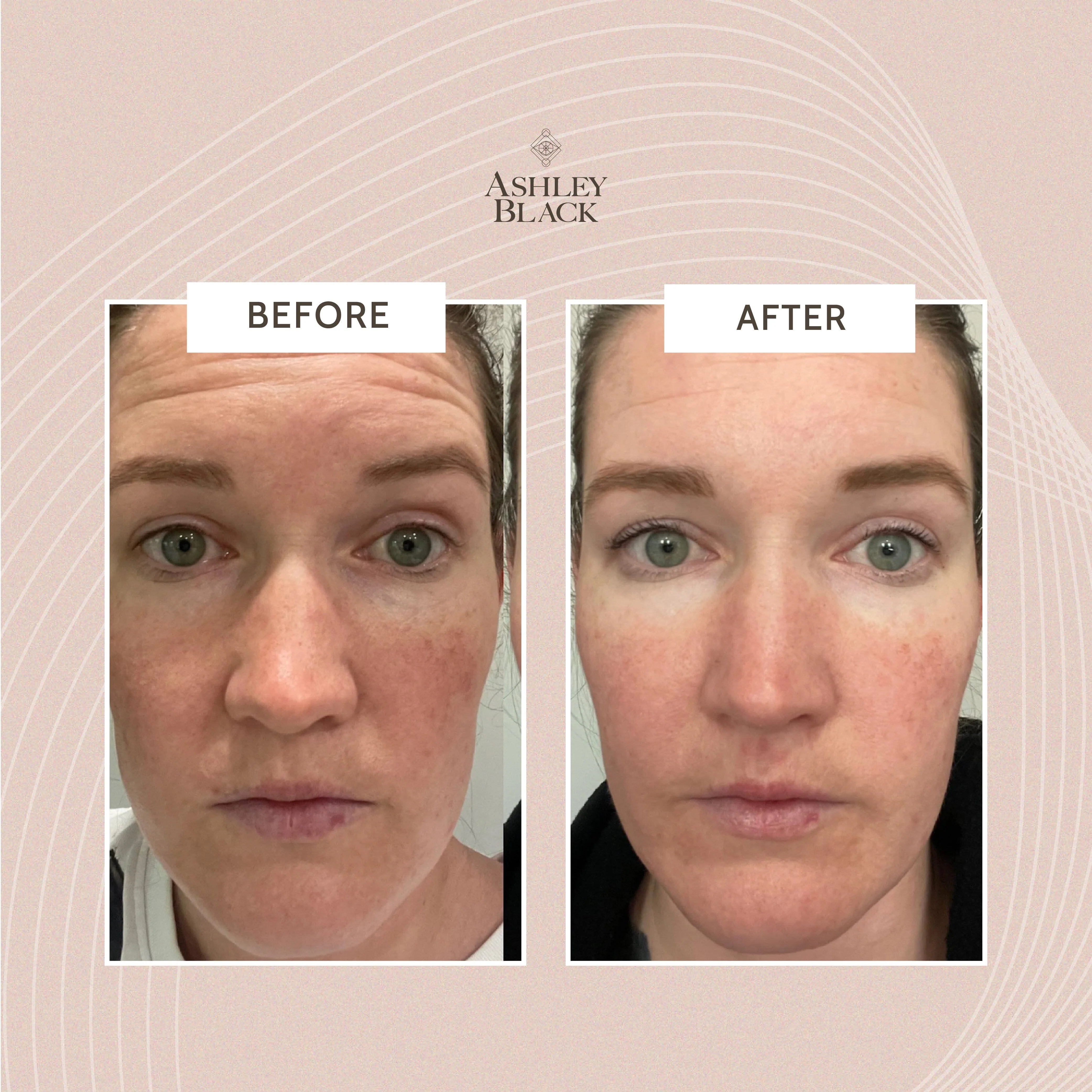 OMGBlaster - Image 5