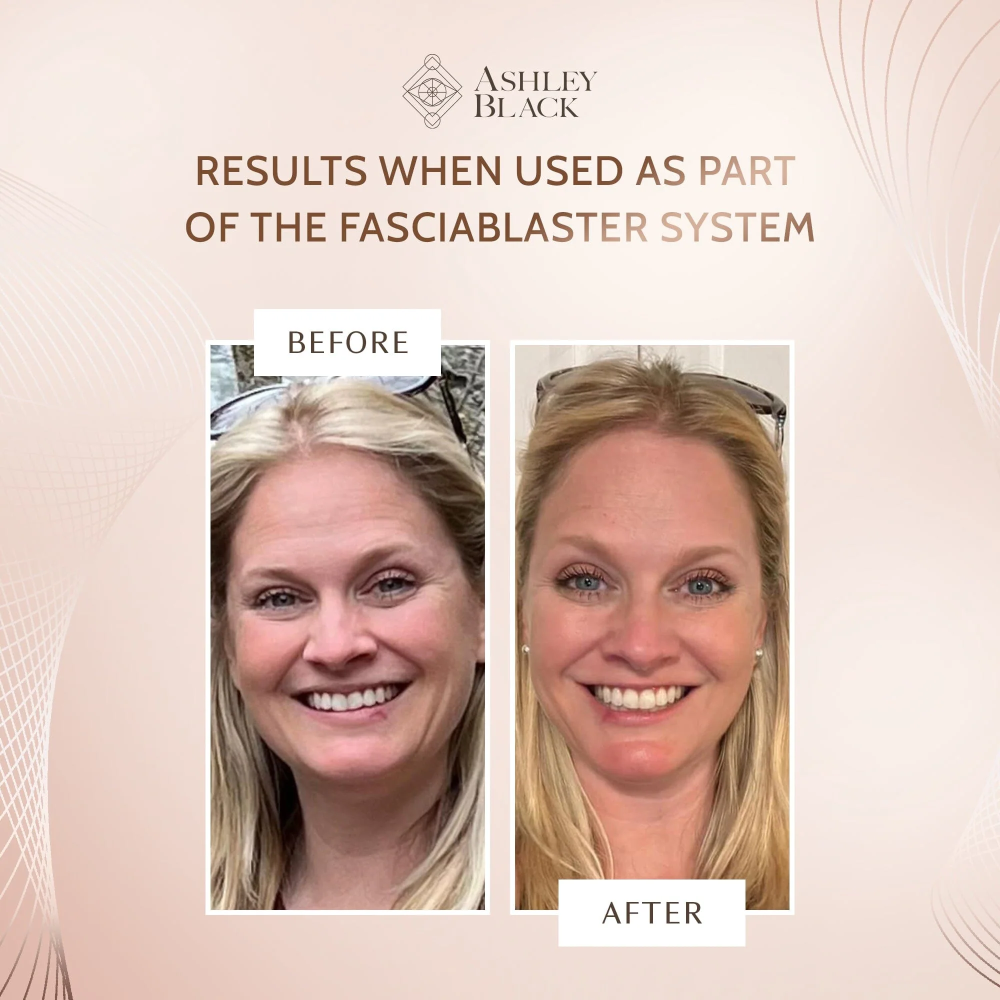 Lymphatic Gua Sha Flusher With Handle - Image 5